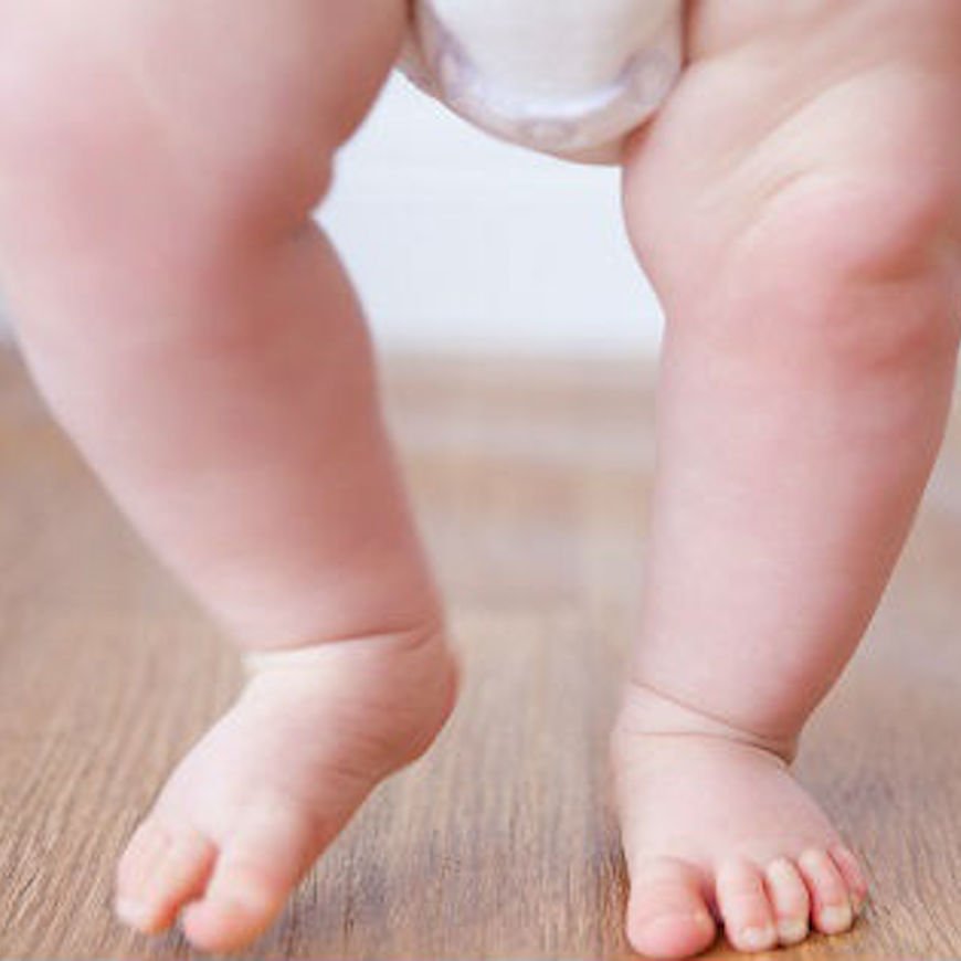 Deficiencia de vitamina D en la edad pediátrica. Una oportunidad de prevención.